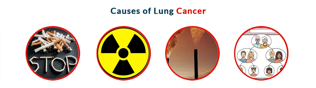 Causes of Lung Cancer